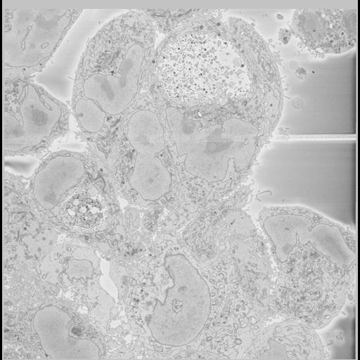  NCBI Organism:Chlamydia trachomatis, ; Cell Types:; Cell Components:; Biological process:;