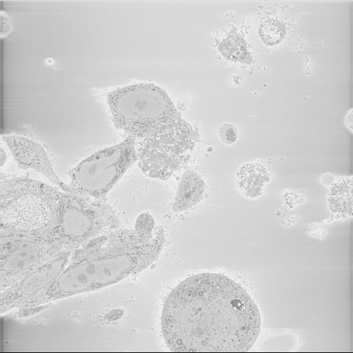  NCBI Organism:Chlamydia trachomatis, ; Cell Types:; Cell Components:; Biological process:;