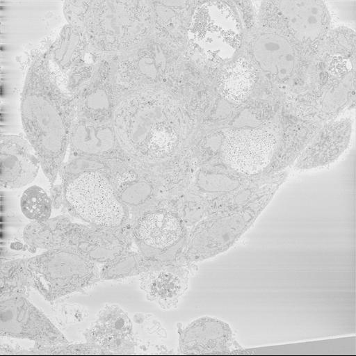  NCBI Organism:Chlamydia trachomatis, ; Cell Types:; Cell Components:; Biological process:;