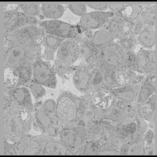  NCBI Organism:Chlamydia trachomatis, ; Cell Types:; Cell Components:; Biological process:;