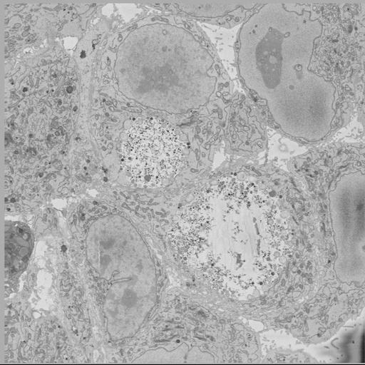  NCBI Organism:Chlamydia trachomatis, ; Cell Types:; Cell Components:; Biological process:;