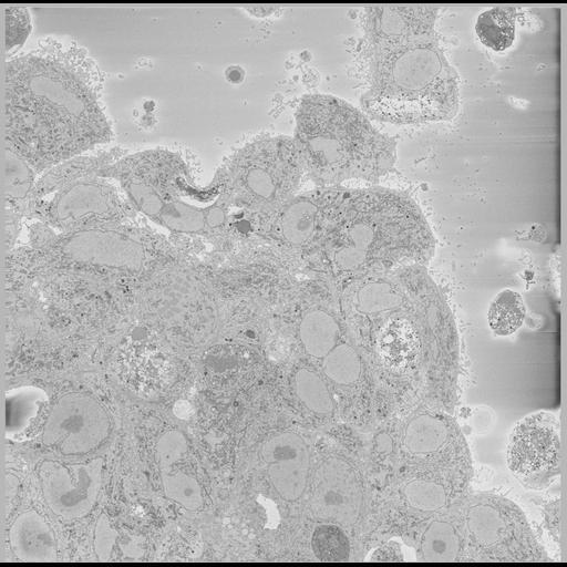  NCBI Organism:Chlamydia trachomatis, ; Cell Types:; Cell Components:; Biological process:;