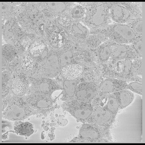  NCBI Organism:Chlamydia trachomatis, ; Cell Types:; Cell Components:; Biological process:;