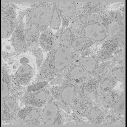  NCBI Organism:Chlamydia trachomatis, ; Cell Types:; Cell Components:; Biological process:;