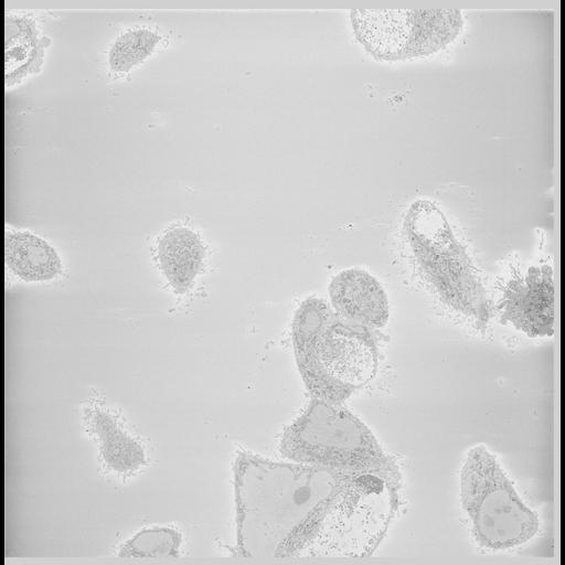  NCBI Organism:Chlamydia trachomatis, ; Cell Types:; Cell Components:; Biological process:;