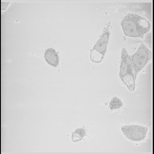  NCBI Organism:Chlamydia trachomatis, ; Cell Types:; Cell Components:; Biological process:;