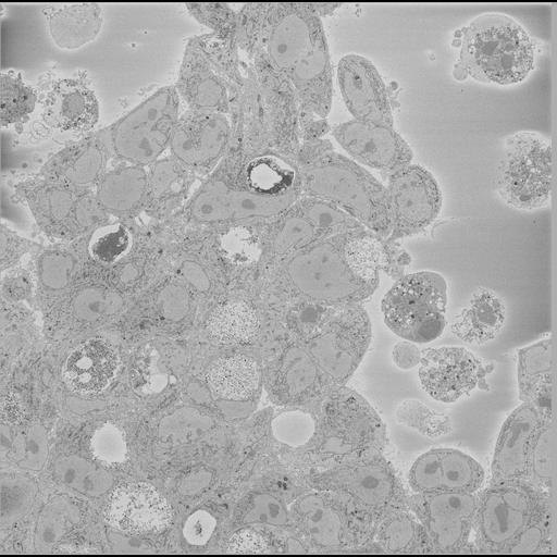  NCBI Organism:Chlamydia trachomatis, ; Cell Types:; Cell Components:; Biological process:;