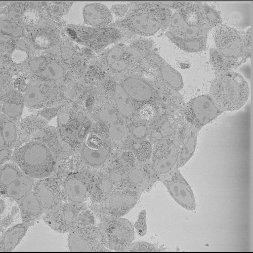  NCBI Organism:Chlamydia trachomatis, ; Cell Types:; Cell Components:; Biological process:;