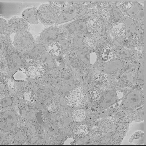  NCBI Organism:Chlamydia trachomatis, ; Cell Types:; Cell Components:; Biological process:;