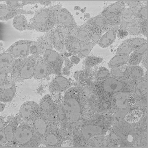  NCBI Organism:Chlamydia trachomatis, ; Cell Types:; Cell Components:; Biological process:;