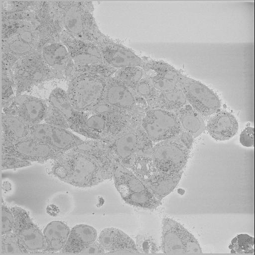  NCBI Organism:Chlamydia trachomatis, ; Cell Types:; Cell Components:; Biological process:;