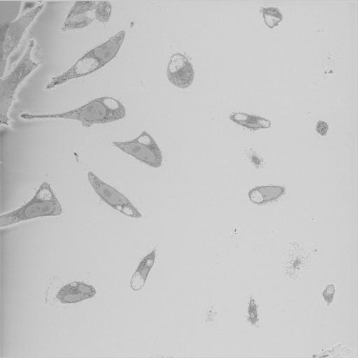  NCBI Organism:Chlamydia trachomatis, ; Cell Types:; Cell Components:; Biological process:;