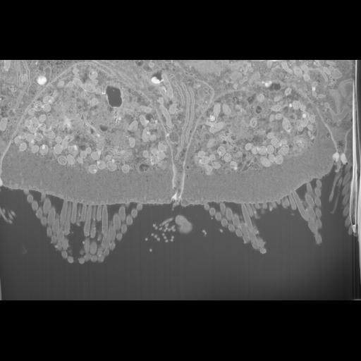  NCBI Organism:Mus musculus, ; Cell Types:; Cell Components:, , , ; Biological process:;