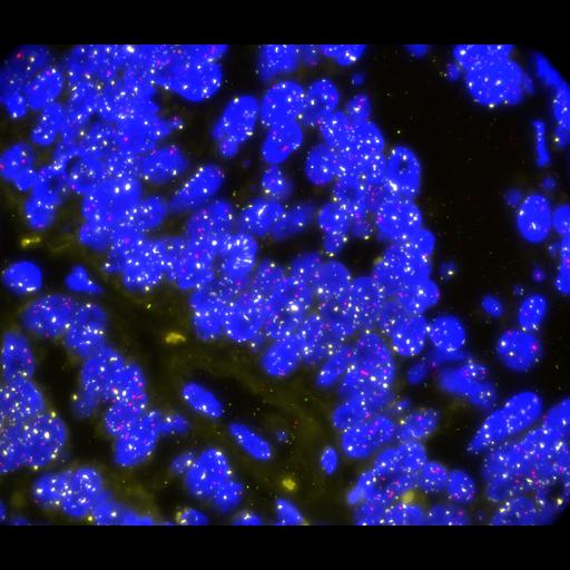  NCBI Organism:Homo sapiens, ; Cell Types:; Cell Components:; Biological process:;