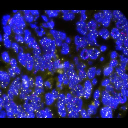  NCBI Organism:Homo sapiens, ; Cell Types:; Cell Components:; Biological process:;