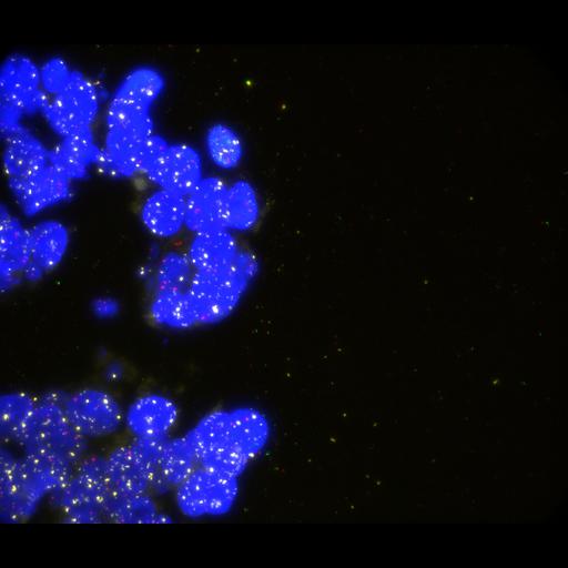  NCBI Organism:Homo sapiens, ; Cell Types:; Cell Components:; Biological process:;