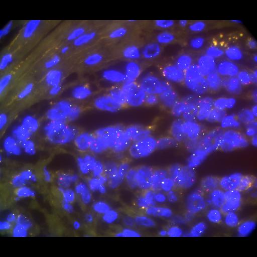  NCBI Organism:Homo sapiens, ; Cell Types:; Cell Components:; Biological process:;