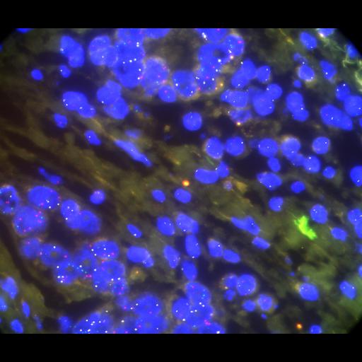  NCBI Organism:Homo sapiens, ; Cell Types:; Cell Components:; Biological process:;