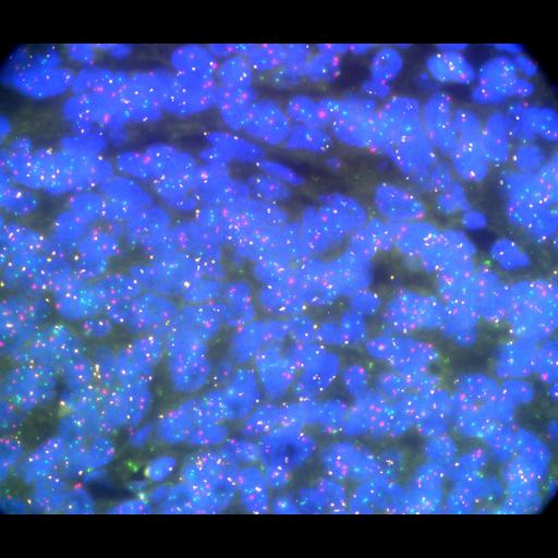  NCBI Organism:Homo sapiens, ; Cell Types:; Cell Components:; Biological process:;