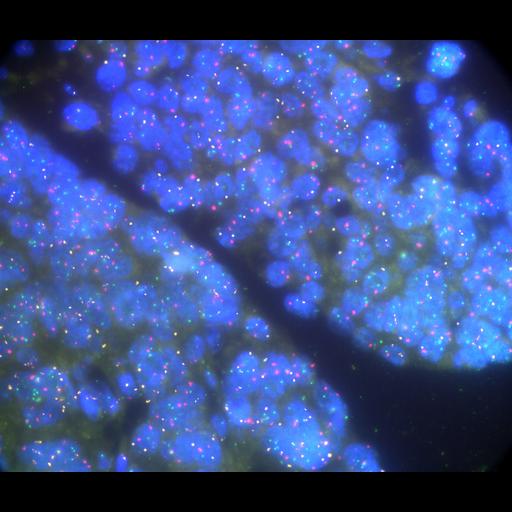  NCBI Organism:Homo sapiens, ; Cell Types:; Cell Components:; Biological process:;