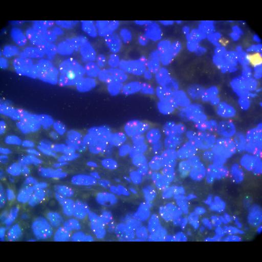  NCBI Organism:Homo sapiens, ; Cell Types:; Cell Components:; Biological process:;