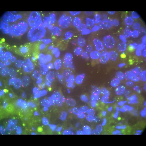  NCBI Organism:Homo sapiens, ; Cell Types:; Cell Components:; Biological process:;