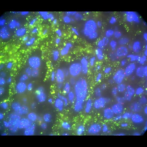  NCBI Organism:Homo sapiens, ; Cell Types:; Cell Components:; Biological process:;