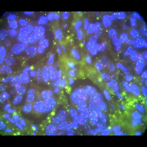  NCBI Organism:Homo sapiens, ; Cell Types:; Cell Components:; Biological process:;