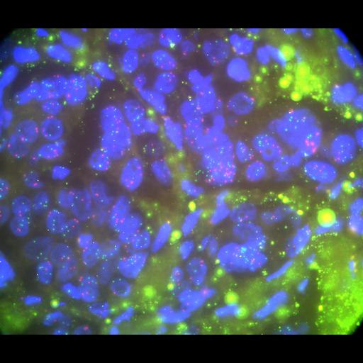  NCBI Organism:Homo sapiens, ; Cell Types:; Cell Components:; Biological process:;