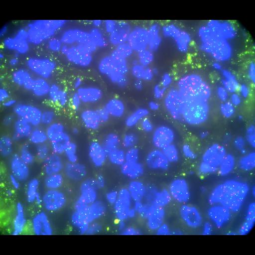  NCBI Organism:Homo sapiens, ; Cell Types:; Cell Components:; Biological process:;