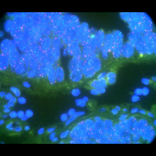  NCBI Organism:Homo sapiens, ; Cell Types:; Cell Components:; Biological process:;