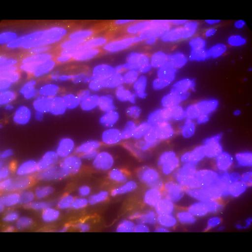  NCBI Organism:Homo sapiens, ; Cell Types:; Cell Components:; Biological process:;