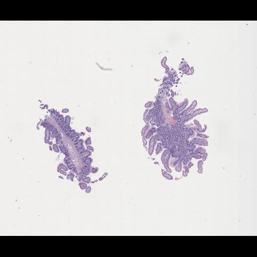  NCBI Organism:Homo sapiens, ; Biological process:;