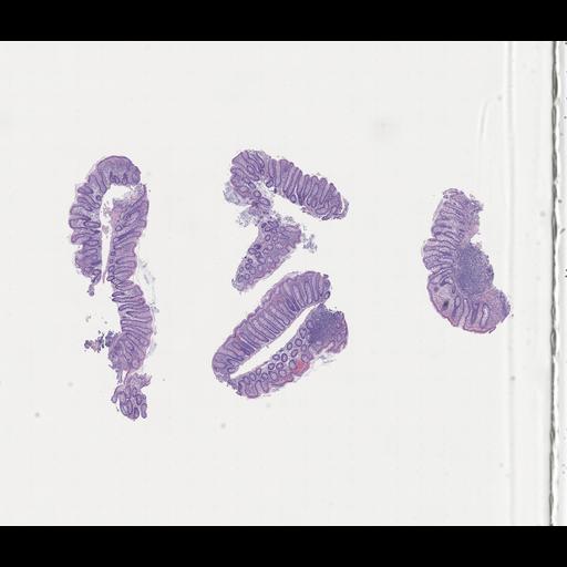  NCBI Organism:Homo sapiens, ; Biological process:;