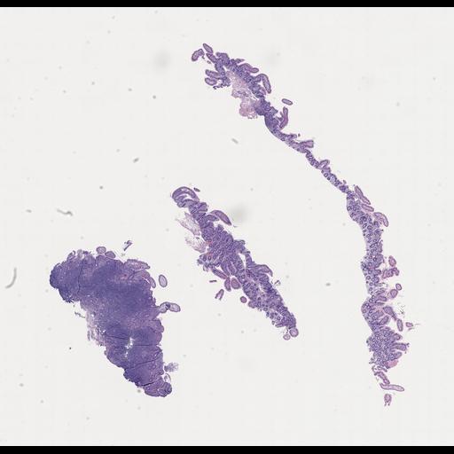  NCBI Organism:Homo sapiens, ; Biological process:;