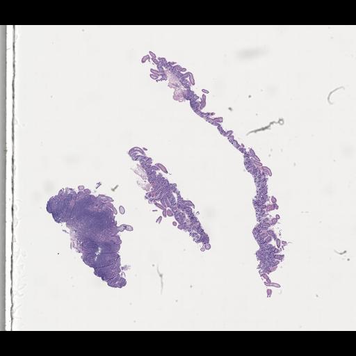  NCBI Organism:Homo sapiens, ; Biological process:;