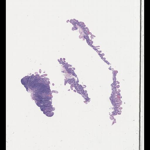  NCBI Organism:Homo sapiens, ; Biological process:;