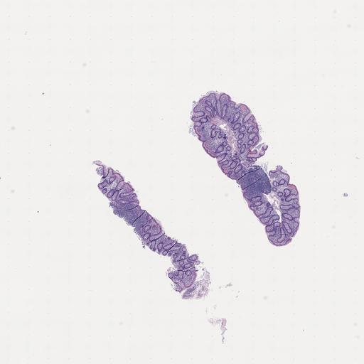  NCBI Organism:Homo sapiens, ; Biological process:;