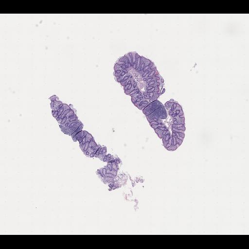  NCBI Organism:Homo sapiens, ; Biological process:;