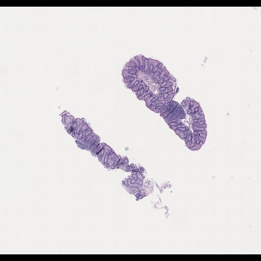  NCBI Organism:Homo sapiens, ; Biological process:;