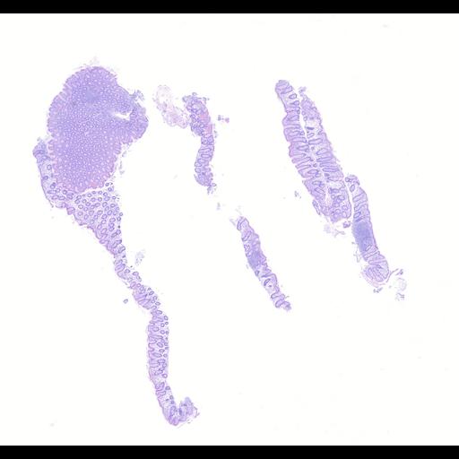  NCBI Organism:Homo sapiens, ; Biological process:;