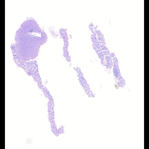  NCBI Organism:Homo sapiens, ; Biological process:;