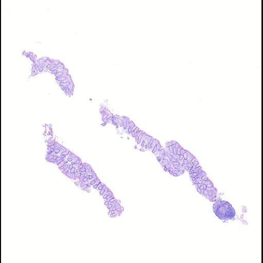  NCBI Organism:Homo sapiens, ; Biological process:;