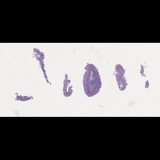  NCBI Organism:Homo sapiens, ; Biological process:;