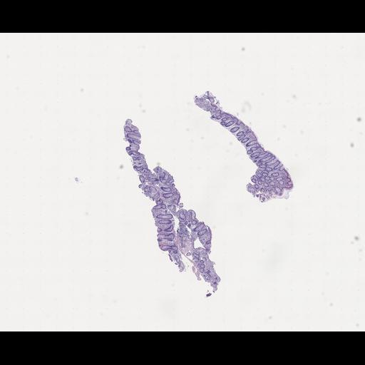  NCBI Organism:Homo sapiens, ; Biological process:;