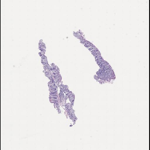  NCBI Organism:Homo sapiens, ; Biological process:;