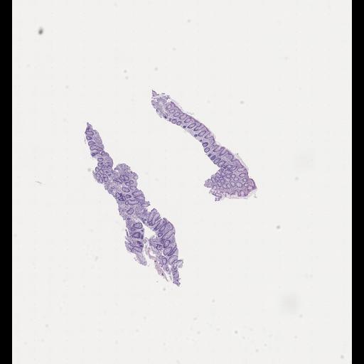  NCBI Organism:Homo sapiens, ; Biological process:;