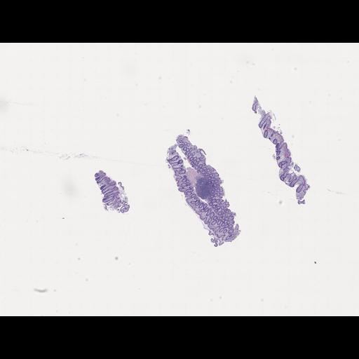  NCBI Organism:Homo sapiens, ; Biological process:;