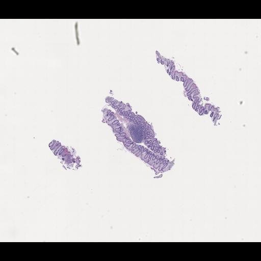  NCBI Organism:Homo sapiens, ; Biological process:;