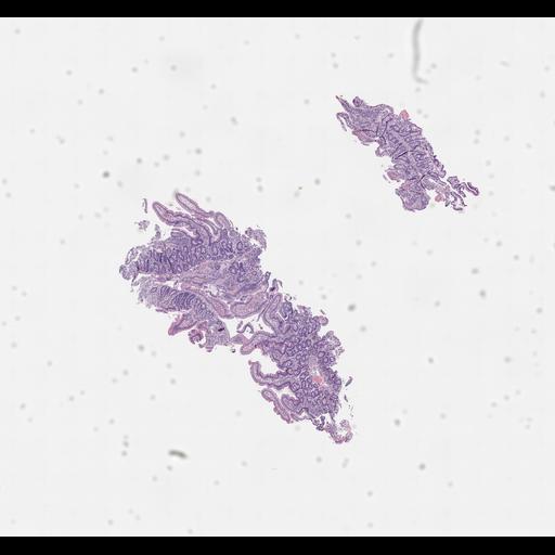  NCBI Organism:Homo sapiens, ; Biological process:;